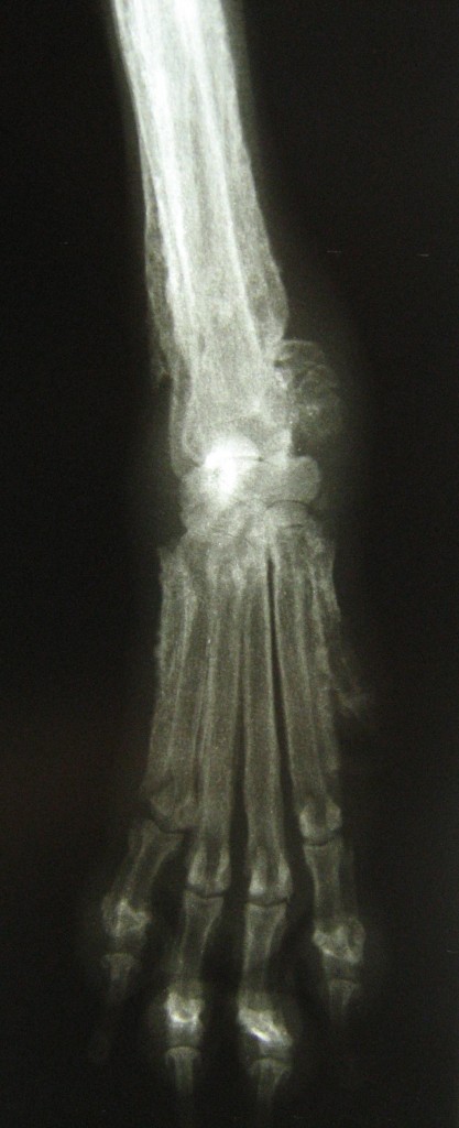 Image radiographique du carpe et du radius droit.