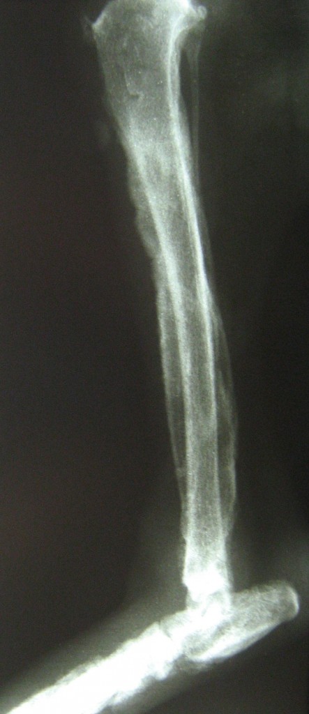 Photo 04 : image radiographique du tibia droit.