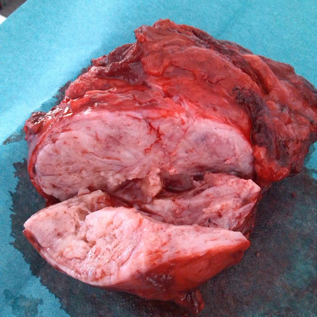 Fig. 5 : Photographie de la masse tumorale après section.