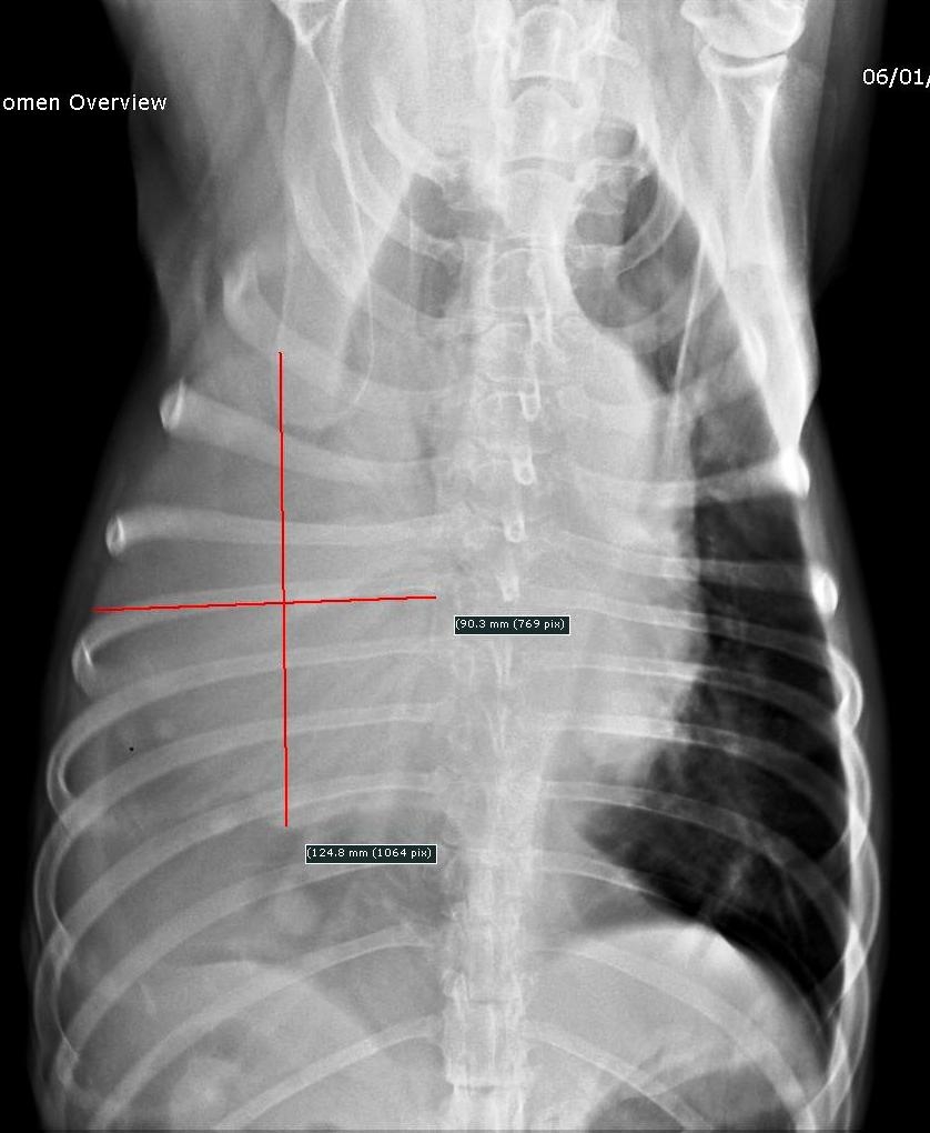 Fig. 12 et 13 : Radiographies de profil (fig. 12) et de face (fig. 13) du thorax de la chienne 5 mois après scapulectomie partielle. Plusieurs masses tumorales sont présentes dans le poumon droit dont la plus grosse a un diamètre de 12*9 cm sur la vue de face.