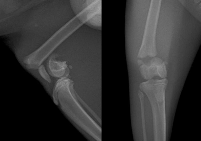 Fracture de Salter Harris du fémur disatl sur un chat de 6 mois